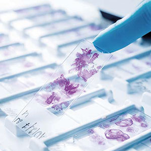 The Center for Outpatient Oncology Tübingen offers tumor diagnostics from different tissue samples.